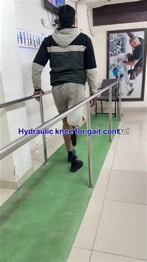 🌟 ABOVE KNEE prosthesis| CAPITAL hydraulic KNEE JOINT| PROFLEX XC foot|#ossur #prostheticlimb