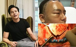 Dedah Video Bedah Otak, Peminat Syukur Nazim Othman Selamat