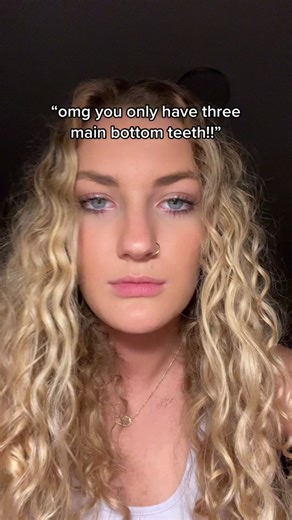 Understanding Hypodontia: A Rare Birth Defect Revealed