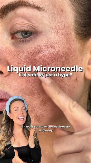 Susie Spring on Instagram: "Is it OK to microneedle daily? 🤯ad Microneedling & lasers are some of the best things you can do for your skin—but they’re expensive, intense, and can be traumatic for your skin. On the other hand, one of the biggest trends of 2025 : VT Reedle Shots - a.k.a Liquid Microneedling But are they worth it? Safe? Or just overhyped? And do they even compare ? Let’s break it down. ⸻ 1️⃣ What it is VT Reedle Shots use a patented micro-spicule technology—tiny needle-like struct