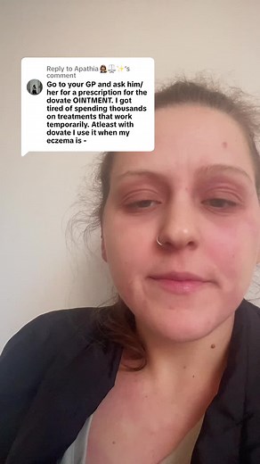 Understanding Dovate for Eczema Treatment