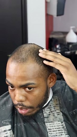 33K views · 749 reactions | Fixing This Clients Bald SPOTS #fypシ゚viralシfypシ゚ #viralpost2025シ #fypviralシ #fypシ #barbertok #barber #HairTransformation #haircuttutorial #beard #edge | Get beamed | Facebook