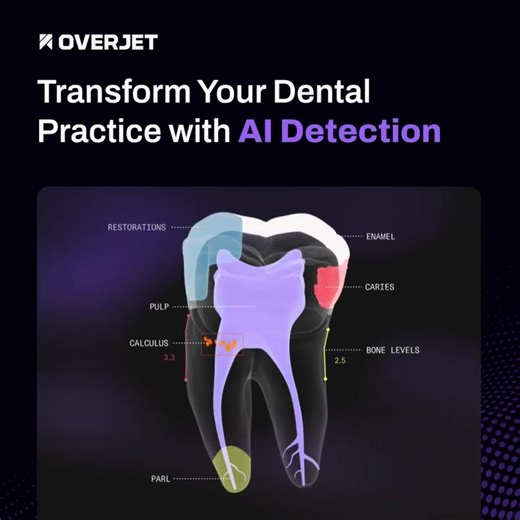AI in dentistry is the new standard for care. Just see what our clients say: “Overjet is like dentistry on steroids. It helps us detect missed diagnoses, integrate providers, follow higher standards for quality care, and also make sure our providers are giving excellent oral health solutions ensuring our patients get to keep their natural teeth for life.” See how it works. 👇 | Overjet