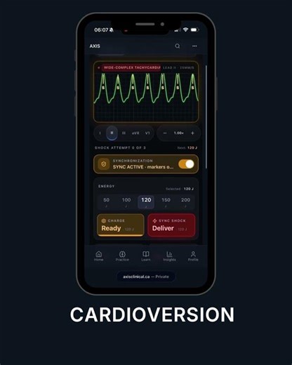 The Human-Factors Risk Behind Synchronized Cardioversion