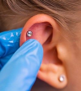 Itchy Piercing: 7 Common Causes And How To Soothe Them