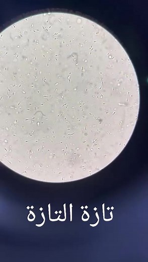 ‏seminal fluid analysis