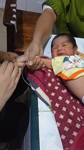 Cannulation of the baby in hospital #cannula #cannulatechnique | Medical practice