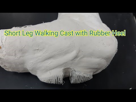 Short Leg Walking Cast With Rubber Heel In The CastRoom