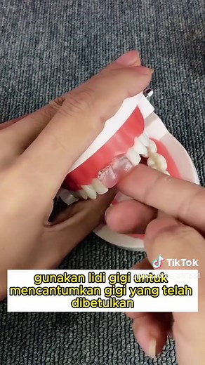 "Temporary Tooth Solution: Say Goodbye to Tooth Problems"