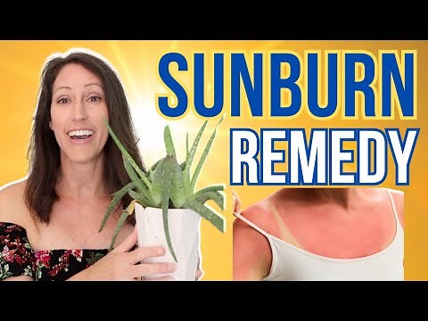 2 Powerful Natural Remedies For Sunburns | FAST Sunburn Relief for Pain & Reduces Peeling