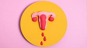 Dysfunctional Uterine Bleeding: Causes, Symptoms, And Remedies