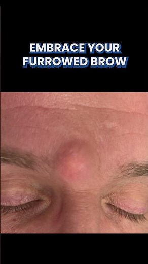 Who knew that having a furrowed brow could be an advantage??⁠⁠