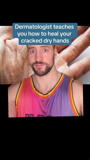 90K views · 896 reactions | Dermatologist teaches you how to heal your cracked dry hands! #dryhands #handeczema #slugging | Dermarkologist | Facebook