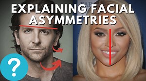 Facial & Neck Asymmetry Patterns: Right TMCC Relationships To Left AIC