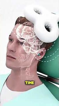 How TMS Therapy Works! #facts #knowledge #interestingfacts #interesting #shorts