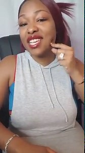 1 Year follow up from TMJ (modified condylotomy) Jaw Surgery