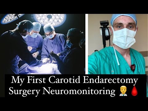 My First Carotid Endarterectomy Neuromonitoring Experience 👨‍⚕️🩸
