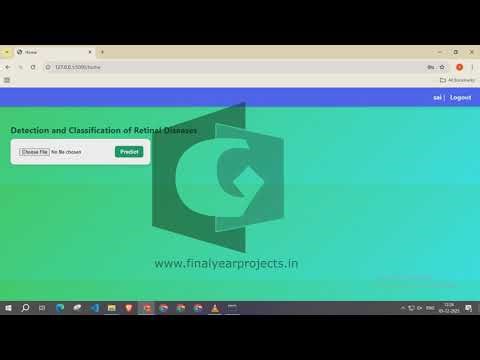 Octascope A Lightweight Pre Trained Model for Optical Coherence Tomography for Retinal diseases