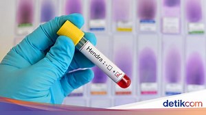 Virus Hendra Itu Apa? Kenali Gejala dan Cara Penularannya