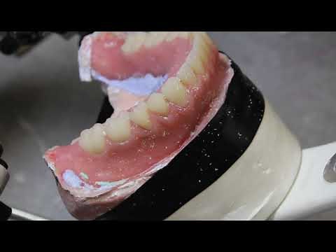 Complete Dentures - Selective Grinding Step-by-Step