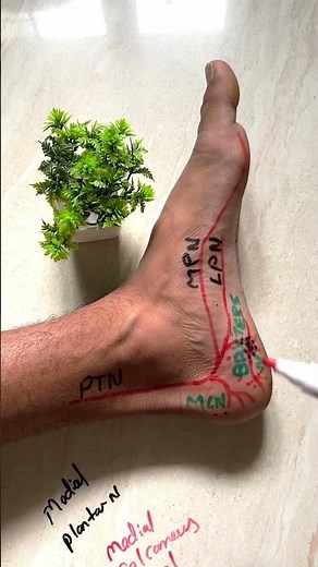 Plantar Fasciitis vs Baxter Nerve Entrapment | Don’t Misdiagnose Heel Pain! #heelpain #nervepain