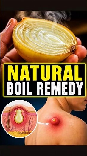The Power of Onions: A Natural Solution for Skin Infections #HolisticHealth