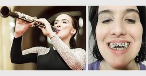 Lawsuits claim dental device wrecked teeth