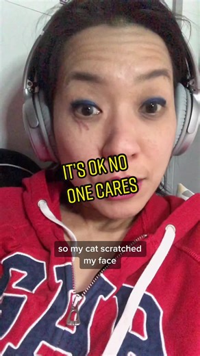 Dealing with Cat Scratches on the Face