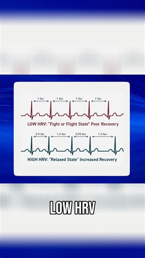 Could measuring heart rate variability (HRV) be the key to reducing bothersome tinnitus? | Doctor Cliff AuD