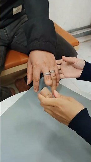 Amputee Gets Realistic Silicone Artificial Finger – Life-Changing Prosthetic! #nevergiveup