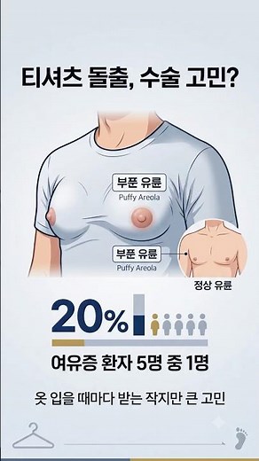Is It Gynecomastia? Just My Nipples and Areolas Are Puffy... Do I Need Nipple Reduction?