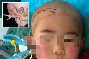 Little boy proves why you should never run with scissors after tripping and accidentally stabbing himself in the face