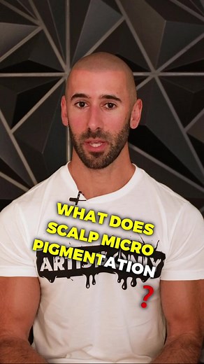 Scalp Micropigmentation 10 Years Later: Before and After
