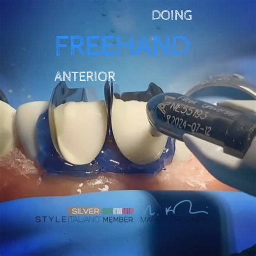 Dental Mentor Pro ®️ on Instagram: "Shape it like a pro! Craft flawless anterior contours with our Proximal Anterior Strips – your secret weapon for natural aesthetics & perfect contacts @drkrupinski"