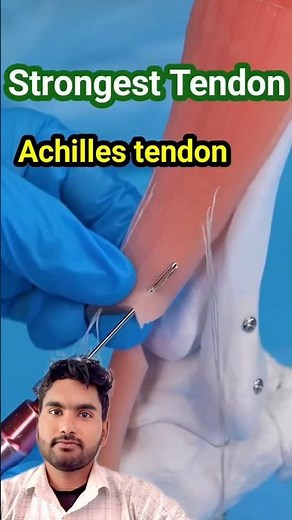 Achilles tendon repair #achillestendon #tendoninjury #tendonsurgery