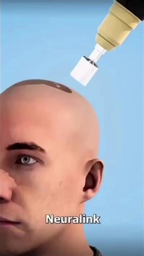 Inside a Brain Operation: What Really Happens?