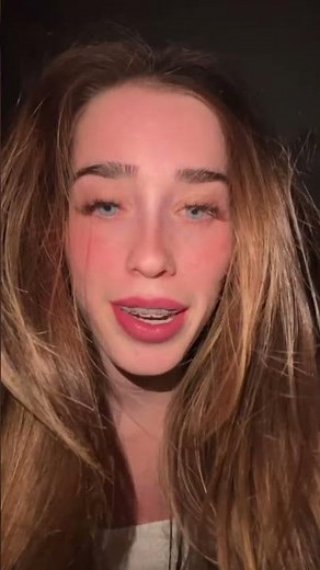 #ASMR braces