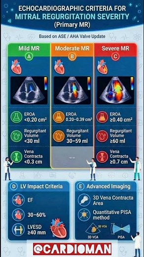 Mitral regurgitation criteria 👉Mild Moderate, Severe