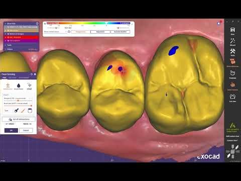 How to make easy Full anatomy crowns with Exocad like pro