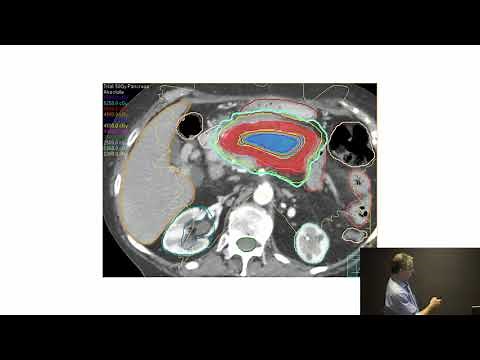 Radiation Oncology Update- New Techniques & Ideas 2/5/20