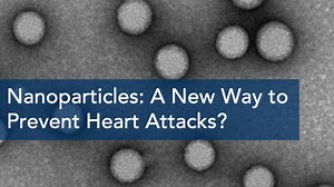 Keeping Atherosclerosis In Check With Novel Targeted Nanomedicines