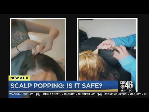Scalp popping - the newest trend