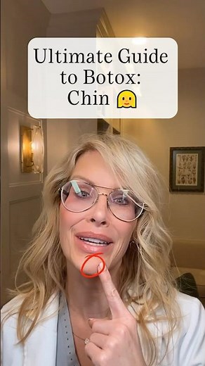 Ultimate Guide to Botox: Chin #botox #beauty #filler
