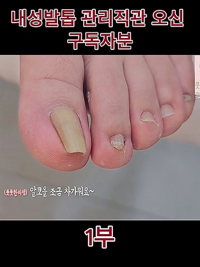 내성발톱 관리와 치료 방법