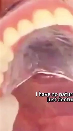 Vous cachez encore votre sourire à cause de dents manquantes ou d’un dentier inconfortable ? 😔 La douleur, la gêne, et la honte de ne pas oser sourire peuvent vite peser sur la confiance en soi… Et les soins dentaires coûtent souvent des milliers d’euros. Avec NovaDent™ – Kit complet haut et bas, retrouvez un sourire naturel en 10 minutes, directement chez vous. Facile à ajuster, confortable à porter, et surtout… personne ne saura que ce n’est pas votre vrai sourire. 💎 Commandez maintenant et 