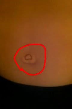 Best belly button