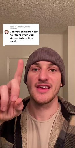 Hair Regrowth Journey Update: Progress with Baby Hairs