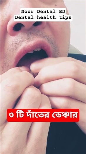 Dental Denture teeth ‪@DentalHealthTips‬