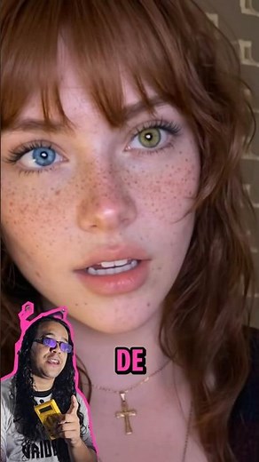 Qual é a cor de olhos mais rara do mundo? #olhos #curiosidades #genetica
