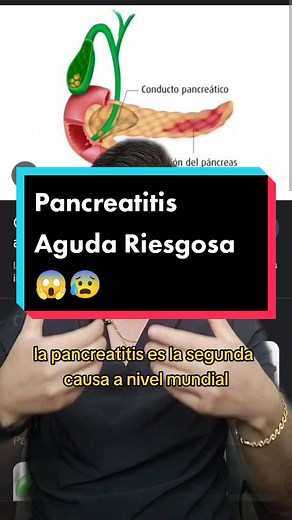 Tratamiento y síntomas de pancreatitis: ¡En vivo este viernes!